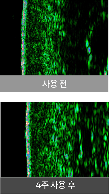 사용 전, 사용 후